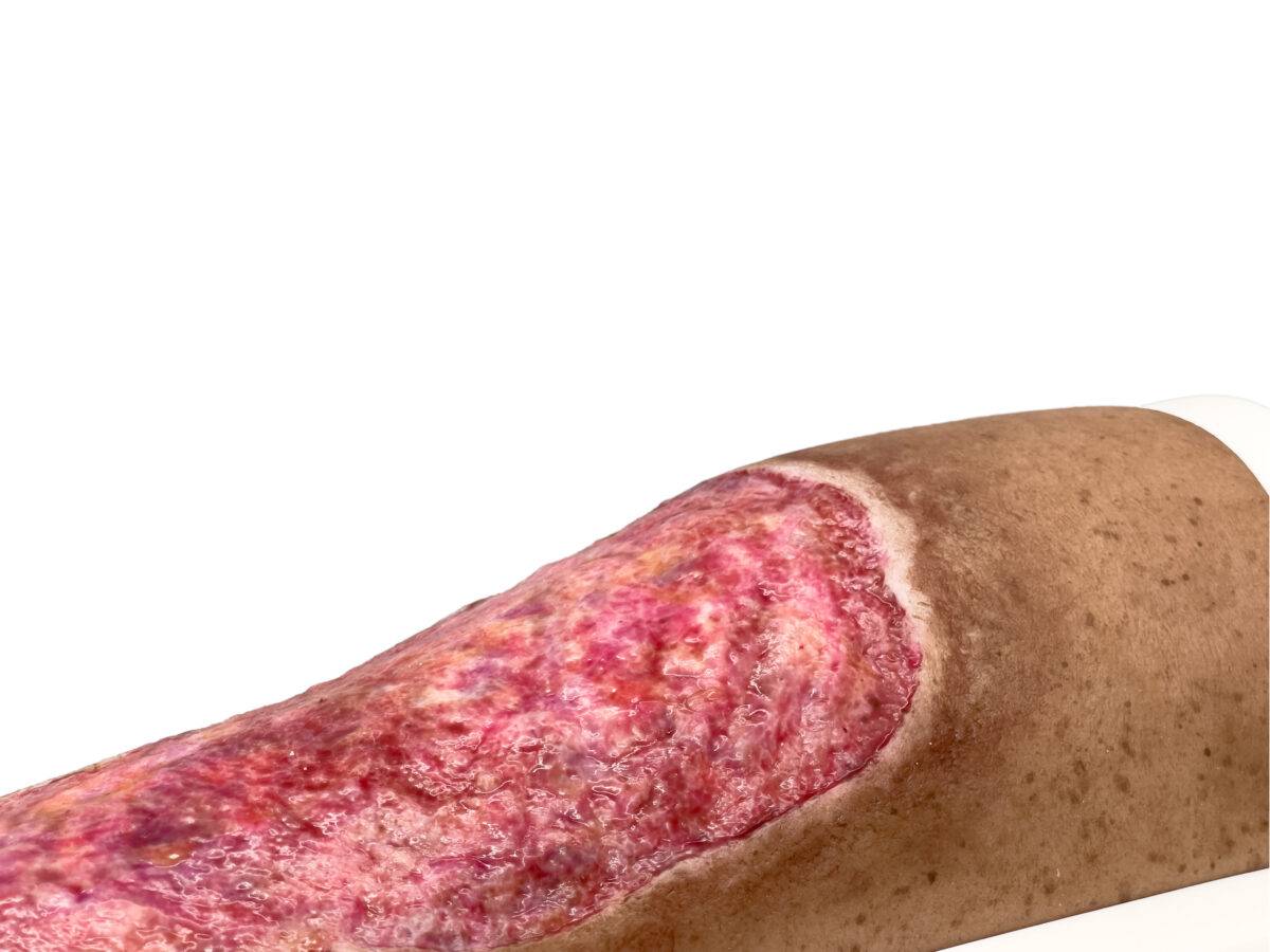 Das „Rahmenmodell Venous Leg Ulcer (VLU)“ von MEDICAL FX Germany stellt ein venöses Beingeschwür dar und ist ein spezialisiertes Lehrmittel, das zur detaillierten Darstellung und…