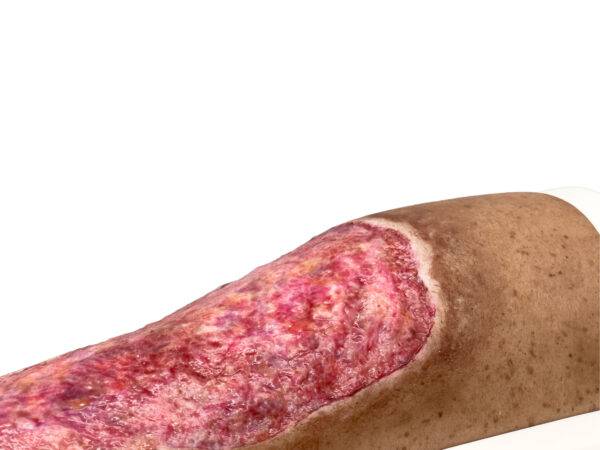 Das „Rahmenmodell Venous Leg Ulcer (VLU)“ von MEDICAL FX Germany stellt ein venöses Beingeschwür dar und ist ein spezialisiertes Lehrmittel, das zur detaillierten Darstellung und…