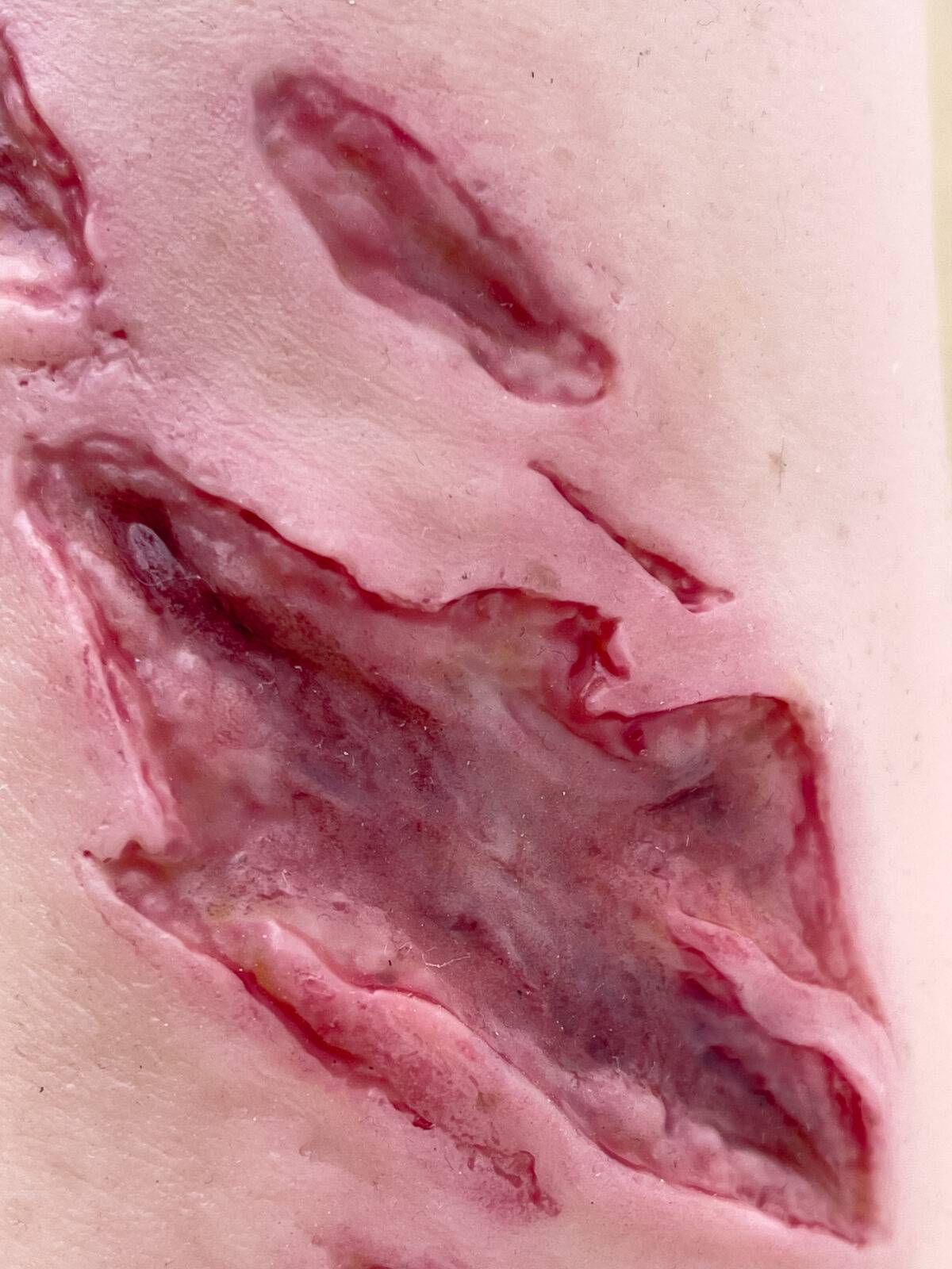 Der „Sleeve Arm mit Risswunde“ von MEDICAL FX Germany ist ein Modell zum Überstülpen, das eine detaillierte Risswunde darstellt und speziell für die Ausbildung in der Wundversorgu…