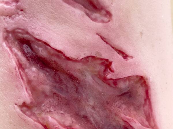 Der „Sleeve Arm mit Risswunde“ von MEDICAL FX Germany ist ein Modell zum Überstülpen, das eine detaillierte Risswunde darstellt und speziell für die Ausbildung in der Wundversorgu…