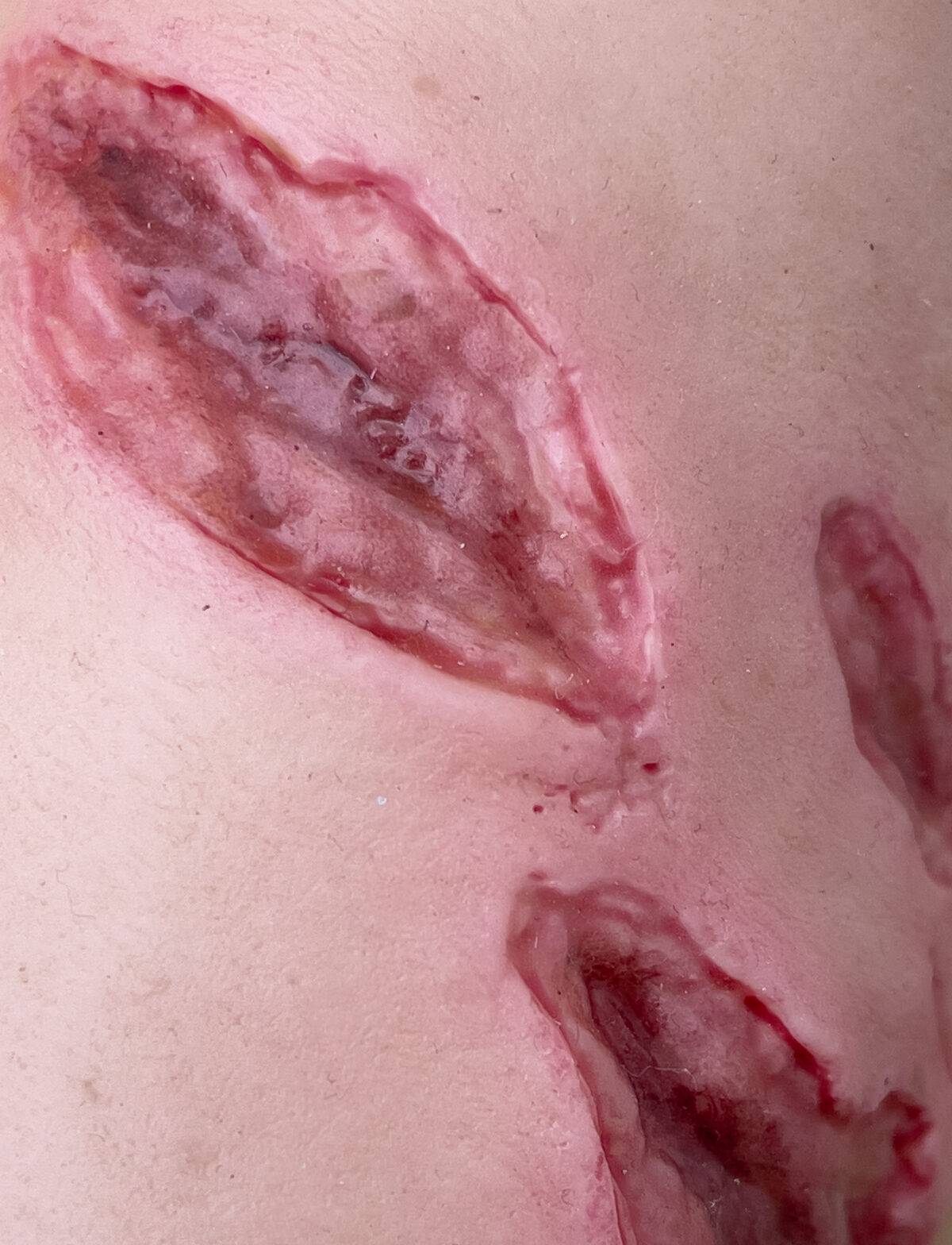 Der „Sleeve Arm mit Risswunde“ von MEDICAL FX Germany ist ein Modell zum Überstülpen, das eine detaillierte Risswunde darstellt und speziell für die Ausbildung in der Wundversorgu…