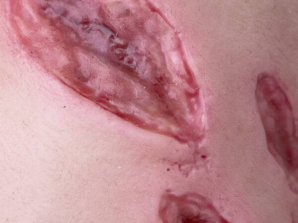 Der „Sleeve Arm mit Risswunde“ von MEDICAL FX Germany ist ein Modell zum Überstülpen, das eine detaillierte Risswunde darstellt und speziell für die Ausbildung in der Wundversorgu…