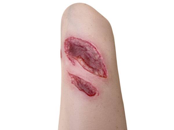 Der „Sleeve Arm mit Risswunde“ von MEDICAL FX Germany ist ein Modell zum Überstülpen, das eine detaillierte Risswunde darstellt und speziell für die Ausbildung in der Wundversorgu…