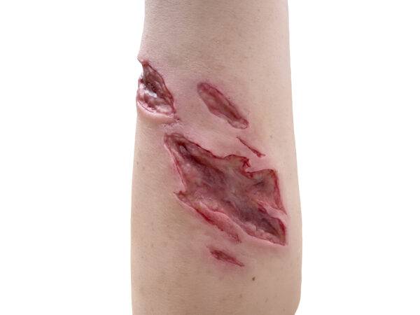 Der „Sleeve Arm mit Risswunde“ von MEDICAL FX Germany ist ein Modell zum Überstülpen, das eine detaillierte Risswunde darstellt und speziell für die Ausbildung in der Wundversorgu…