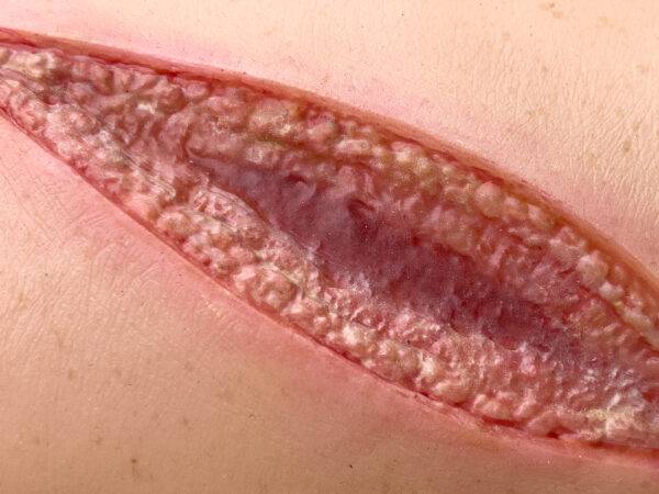 Der „Sleeve Arm mit Schnittwunde“ von MEDICAL FX Germany stellt eine realistische Schnittwunde dar, die detailliert nachgebildet ist, um die Anforderungen an eine effektive Wundbe…