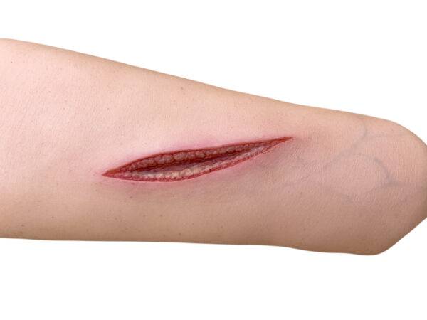 Der „Sleeve Arm mit Schnittwunde“ von MEDICAL FX Germany stellt eine realistische Schnittwunde dar, die detailliert nachgebildet ist, um die Anforderungen an eine effektive Wundbe…