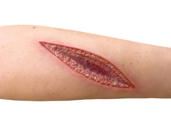 Der „Sleeve Arm mit Schnittwunde“ von MEDICAL FX Germany stellt eine realistische Schnittwunde dar, die detailliert nachgebildet ist, um die Anforderungen an eine effektive Wundbe…