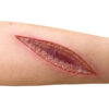 Sleeve Arm mit Schnittwunde medicalfx detail scaled