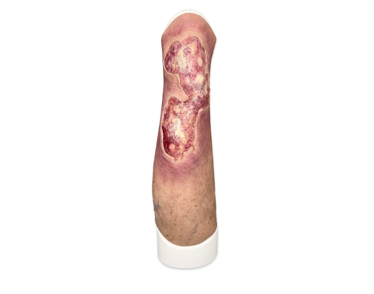 Das Wundmodell „Sleeve Bein mit Gamaschenulkus“ von MEDICAL FX Germany ist ein hochspezialisiertes Trainingswerkzeug, das für das medizinische Training zur Behandlung von venösen…