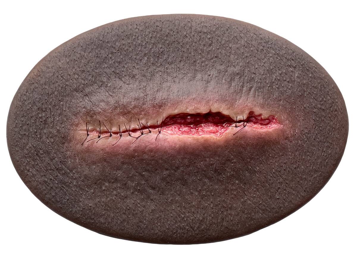 Das Silikonmodell „Stick-On Medium OP Wunde halboffen" von MEDICAL FX Germany ist die Darstellung einer halboffenen Operationswunde in mittlerer Größe, die speziell für Ausbildung…