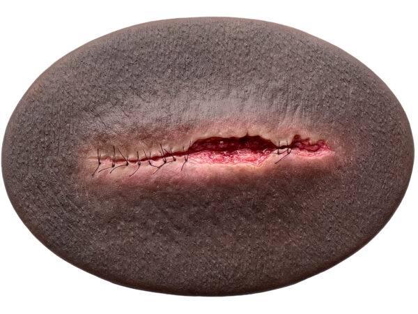 Das Silikonmodell „Stick-On Medium OP Wunde halboffen" von MEDICAL FX Germany ist die Darstellung einer halboffenen Operationswunde in mittlerer Größe, die speziell für Ausbildung…