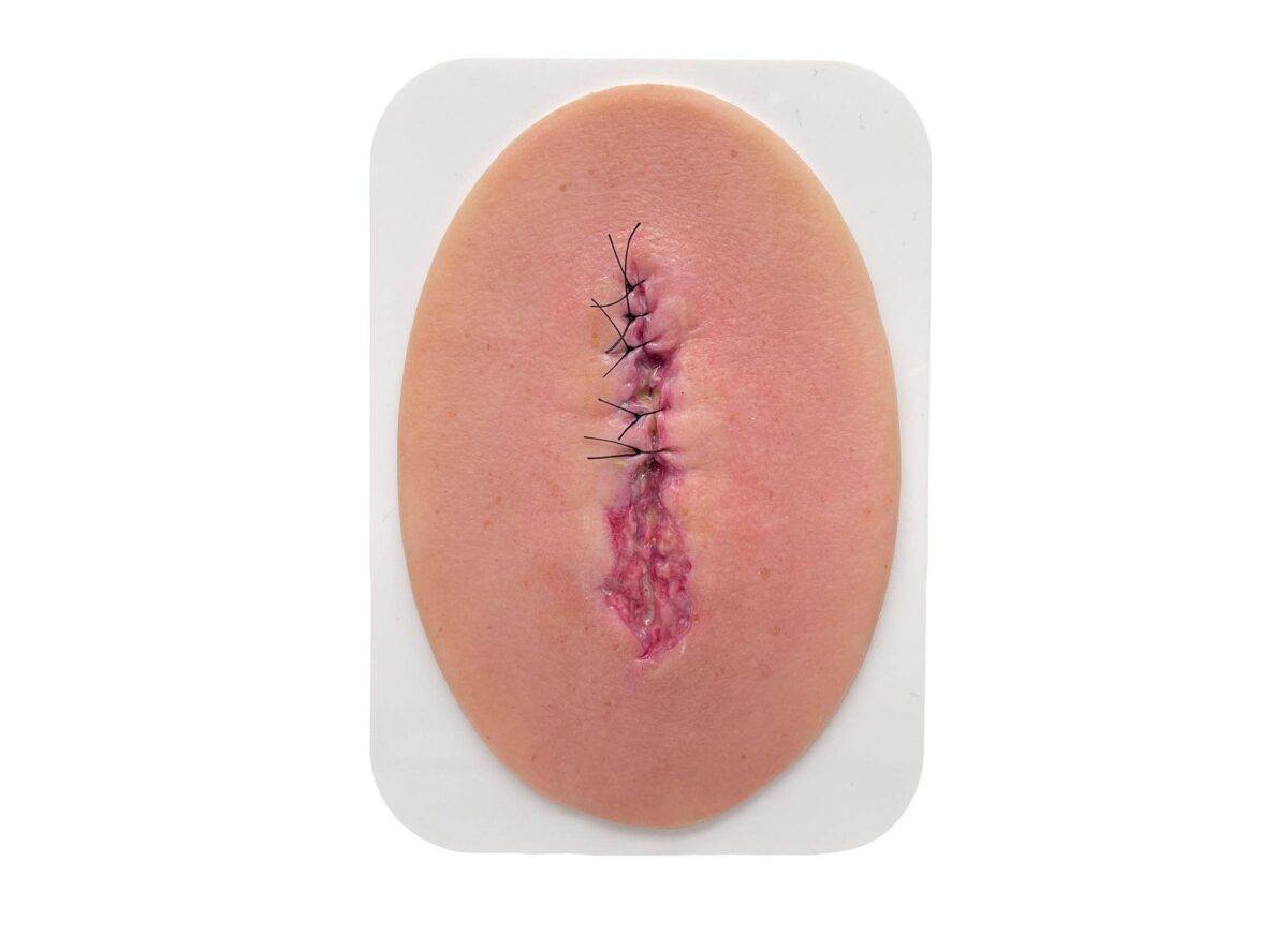 Das Modell „Stick-On Small OP-Wunde geöffnet“ von MEDICAL FX Germany bietet eine realistische Darstellung einer geöffneten Operationswunde und dient als ausgezeichnetes Lehrmittel…