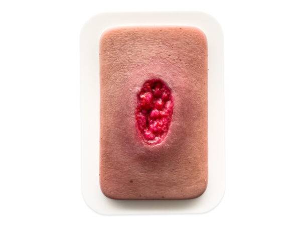 Das Modell „Pocketwunde Hypergranulation“ von MEDICAL FX Germany bietet eine detaillierte Darstellung des Zustands der Hypergranulation, einem wichtigen Aspekt im Bereich des Wund…