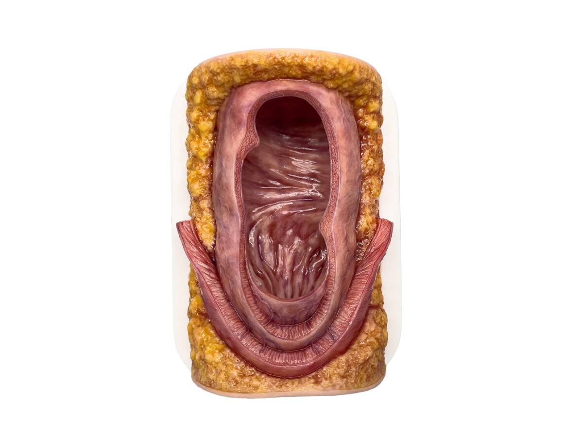 Das „Rahmenmodell Enddarm-Simulator Small" von MEDICAL FX Germany ist ein hochwertiges, realistisches Trainingsmodell, das speziell für medizinische Schulungen und Übungen entwick…