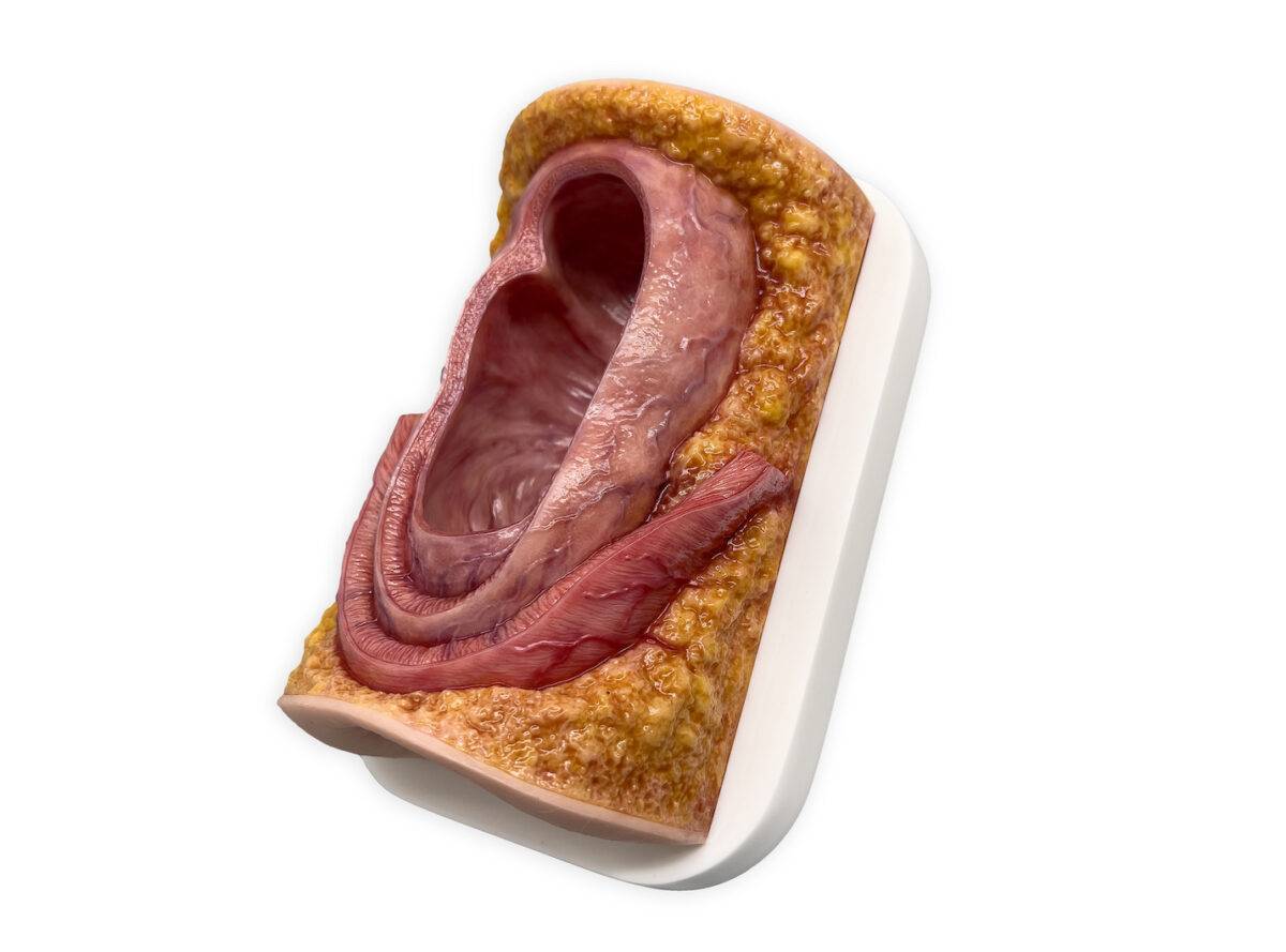 Das „Rahmenmodell Enddarm-Simulator Small" von MEDICAL FX Germany ist ein hochwertiges, realistisches Trainingsmodell, das speziell für medizinische Schulungen und Übungen entwick…