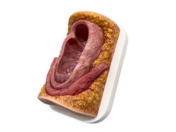 Das „Rahmenmodell Enddarm-Simulator Small" von MEDICAL FX Germany ist ein hochwertiges, realistisches Trainingsmodell, das speziell für medizinische Schulungen und Übungen entwick…