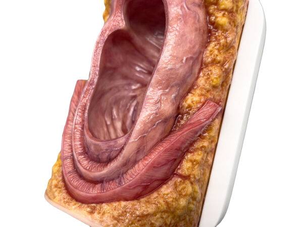 Das „Rahmenmodell Enddarm-Simulator Small" von MEDICAL FX Germany ist ein hochwertiges, realistisches Trainingsmodell, das speziell für medizinische Schulungen und Übungen entwick…