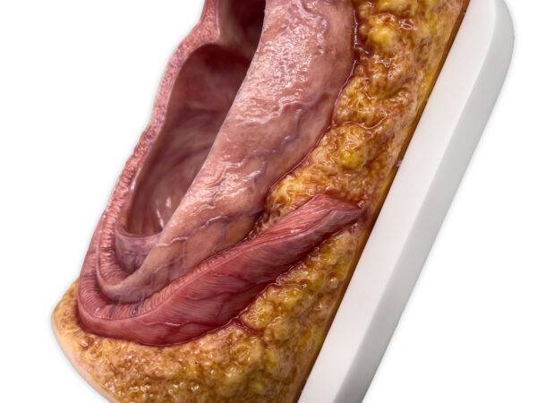 Das „Rahmenmodell Enddarm-Simulator Small" von MEDICAL FX Germany ist ein hochwertiges, realistisches Trainingsmodell, das speziell für medizinische Schulungen und Übungen entwick…