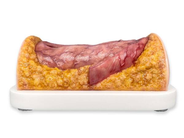 Das „Rahmenmodell Enddarm-Simulator Small" von MEDICAL FX Germany ist ein hochwertiges, realistisches Trainingsmodell, das speziell für medizinische Schulungen und Übungen entwick…