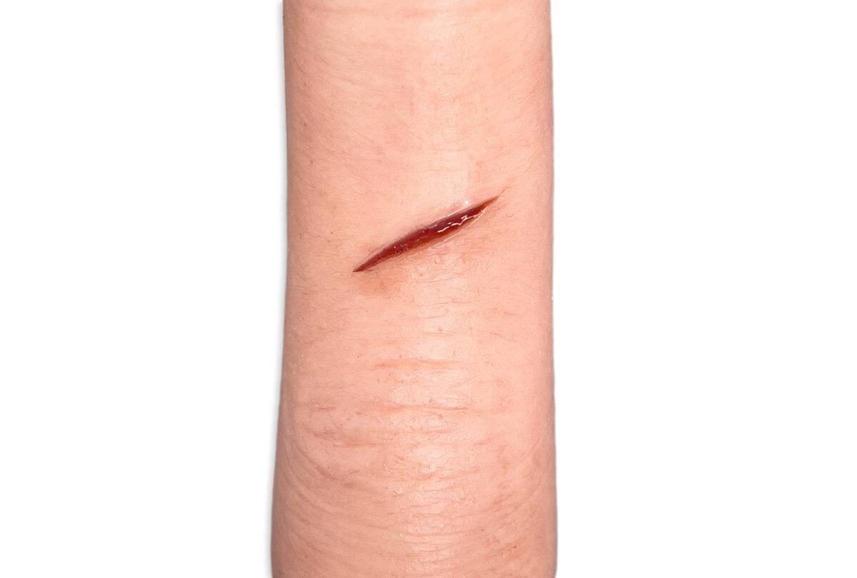 Das Modell „Sleeve Finger mit akuter Schnittverletzung" von MEDICAL FX Germany ist ein hochrealistischer Fingersleeve, der eine akute Schnittverletzung simuliert. Dieser hochwerti…