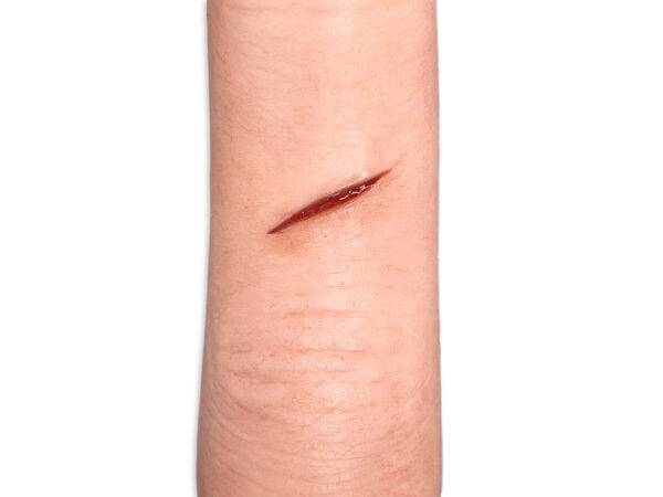 Das Modell „Sleeve Finger mit akuter Schnittverletzung" von MEDICAL FX Germany ist ein hochrealistischer Fingersleeve, der eine akute Schnittverletzung simuliert. Dieser hochwerti…