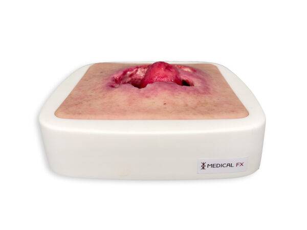 Das „Rahmenmodell Stomaausriss“ von MEDICAL FX Germany stellt einen realistischen Stomaausriss dar und eignet sich ideal für medizinische Schulungen und Simulationen. Gefertigt au…