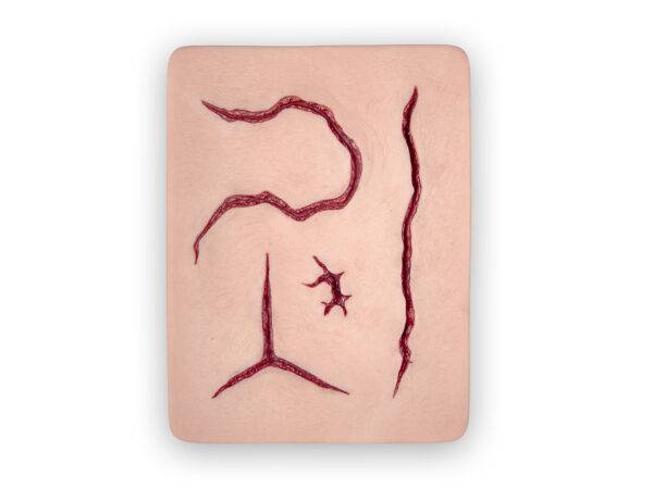 Das Modell „Suture Pad Nahtsimulator Large" von MEDICAL FX Germany ist ein hochwertiges Übungsmodell aus Silikon, das speziell für das Training chirurgischer Nähtechniken entwicke…