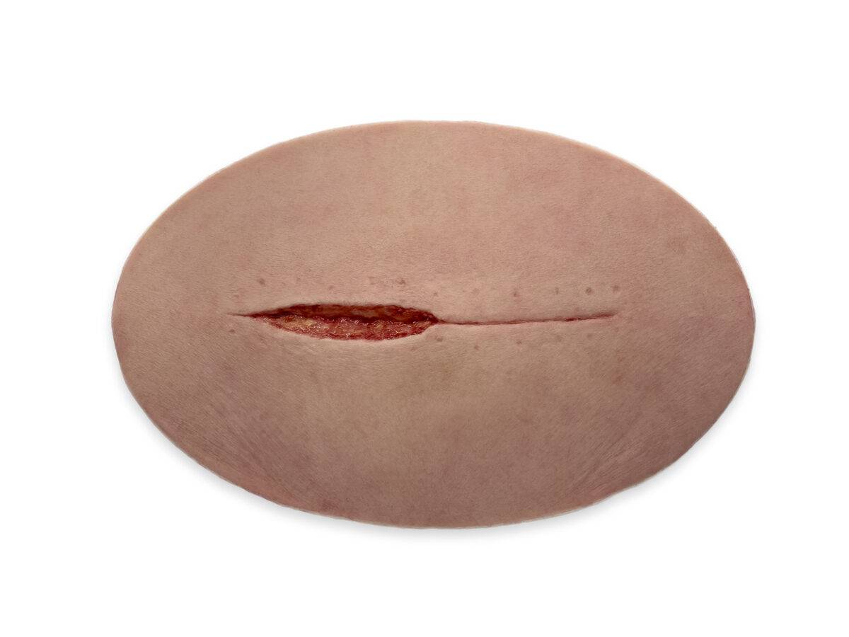 Das „Stick-On Large Kaiserschnitt“-Modell ermöglicht eine realistische Darstellung einer Kaiserschnittnarbe. Aus hochwertigem Silikon gefertigt, bietet es eine lebensechte Textur…