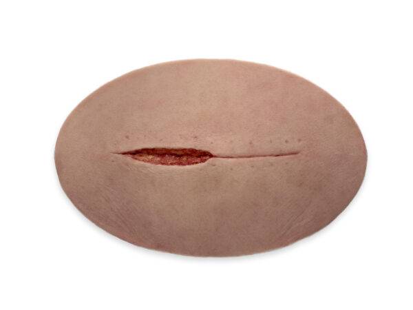 Das „Stick-On Large Kaiserschnitt“-Modell ermöglicht eine realistische Darstellung einer Kaiserschnittnarbe. Aus hochwertigem Silikon gefertigt, bietet es eine lebensechte Textur…