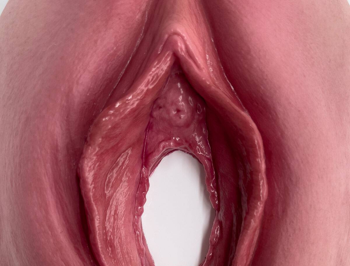 Das „Stick-On Medium Dammriss 1. Grades“-Modell von MEDICAL FX Germany ermöglicht eine realistische Darstellung eines Dammrisses 1. Grades. Aus hochwertigem Silikon gefertigt, übe…