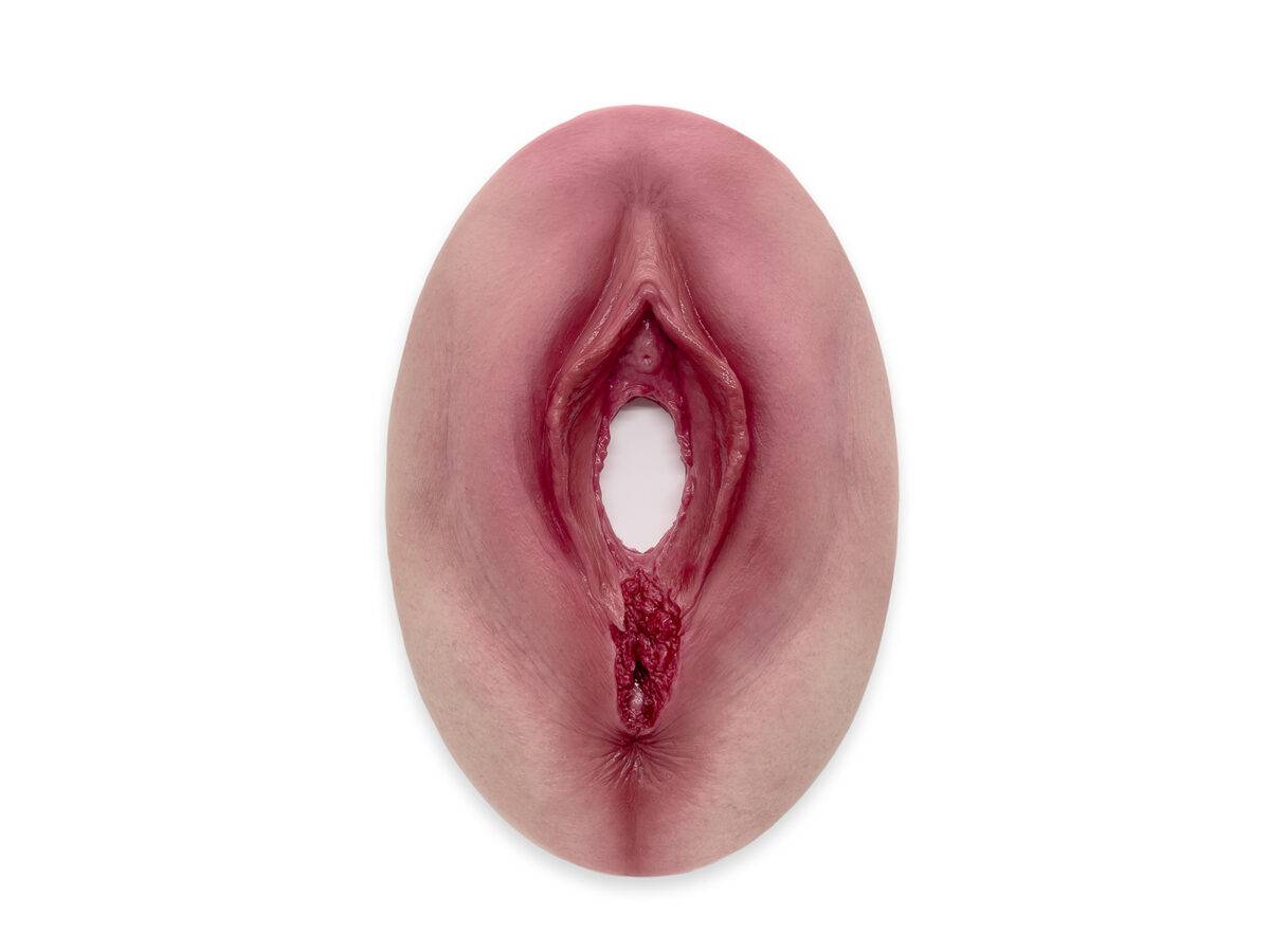 Das „Stick-On Medium Dammriss 3. Grades“-Modell von MEDICAL FX Germany bietet eine realistische Darstellung eines Dammrisses 3. Grades. Hergestellt aus hochwertigem Silikon, besti…