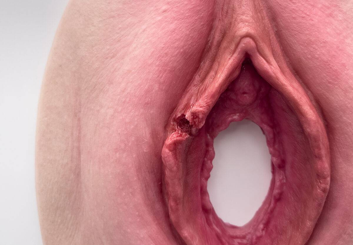 Das „Stick-On Medium Labienriss“-Modell von MEDICAL FX Germany ermöglicht eine realistische Darstellung eines Labienrisses. Gefertigt aus hochwertigem Silikon, bietet es eine natu…