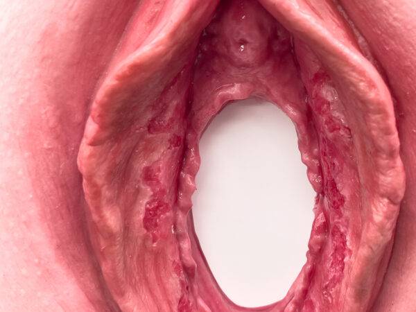 Das „Stick-On Medium Labienschürfung“-Modell von MEDICAL FX Germany bietet eine realistische Darstellung einer Labienschürfung. Hergestellt aus hochwertigem, medizinischem Silikon…