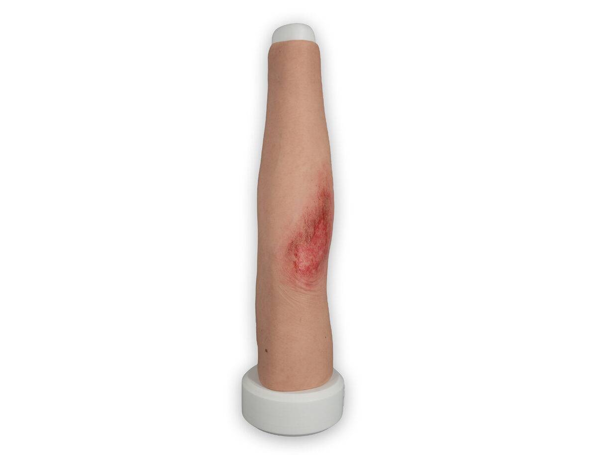 Das Modell „Sleeve Long Arm-Schürfwunde“ von MEDICAL FX Germany zeigt eine realistisch gestaltete Verletzung am Unterarm bis in den Bereich des Ellbogens. Das überziehbare Sleeve…