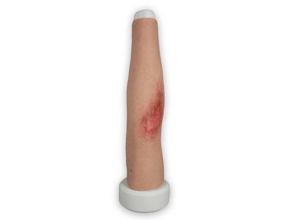 Das Modell „Sleeve Long Arm-Schürfwunde“ von MEDICAL FX Germany zeigt eine realistisch gestaltete Verletzung am Unterarm bis in den Bereich des Ellbogens. Das überziehbare Sleeve…