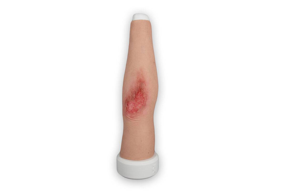 Das Modell „Sleeve Long Arm-Schürfwunde“ von MEDICAL FX Germany zeigt eine realistisch gestaltete Verletzung am Unterarm bis in den Bereich des Ellbogens. Das überziehbare Sleeve…