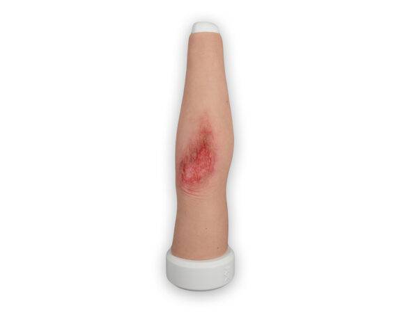 Das Modell „Sleeve Long Arm-Schürfwunde“ von MEDICAL FX Germany zeigt eine realistisch gestaltete Verletzung am Unterarm bis in den Bereich des Ellbogens. Das überziehbare Sleeve…