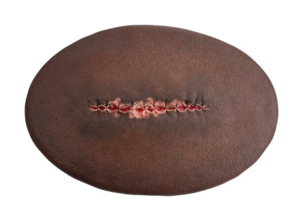 Das Wundmodell „Stick-On Medium Operationswunde mit entzündeter Nahtdehiszenz“ von MEDICAL FX Germany ist ein hochrealistisches Silikonmodell zur Darstellung einer entzündeten pos…