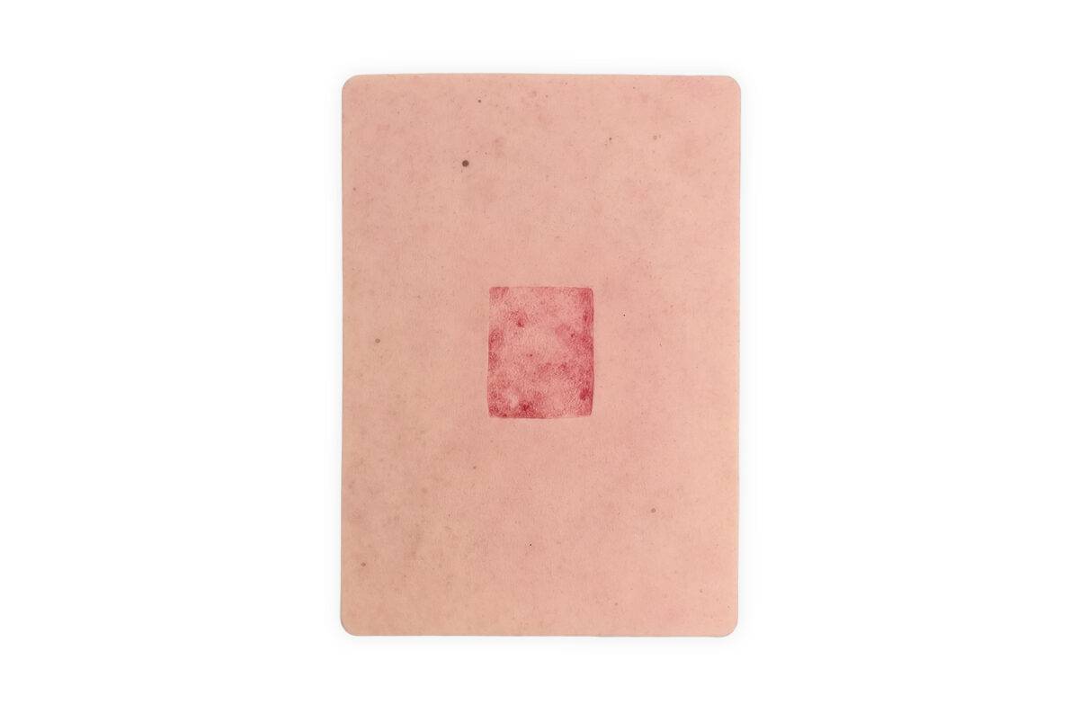 Die „Tabletwunde Hauttransplantation – Donorstelle“ von MEDICAL FX Germany ist ein hochwertiges, handgefertigtes Wundmodell aus Silikon in Tabletgröße. Sie zeigt eine typische Ent…