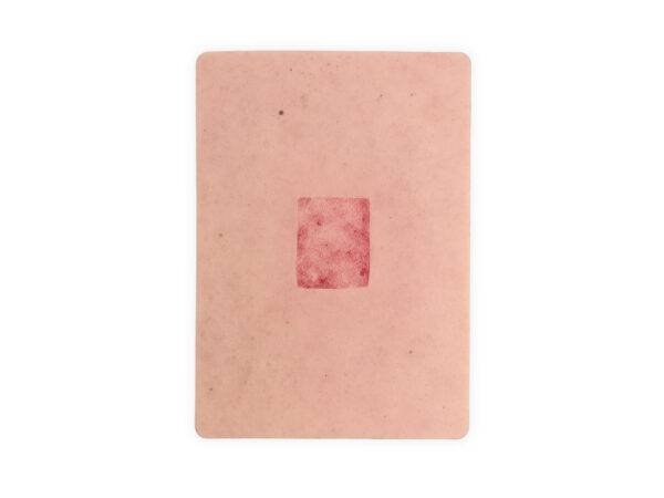 Die „Tabletwunde Hauttransplantation – Donorstelle“ von MEDICAL FX Germany ist ein hochwertiges, handgefertigtes Wundmodell aus Silikon in Tabletgröße. Sie zeigt eine typische Ent…