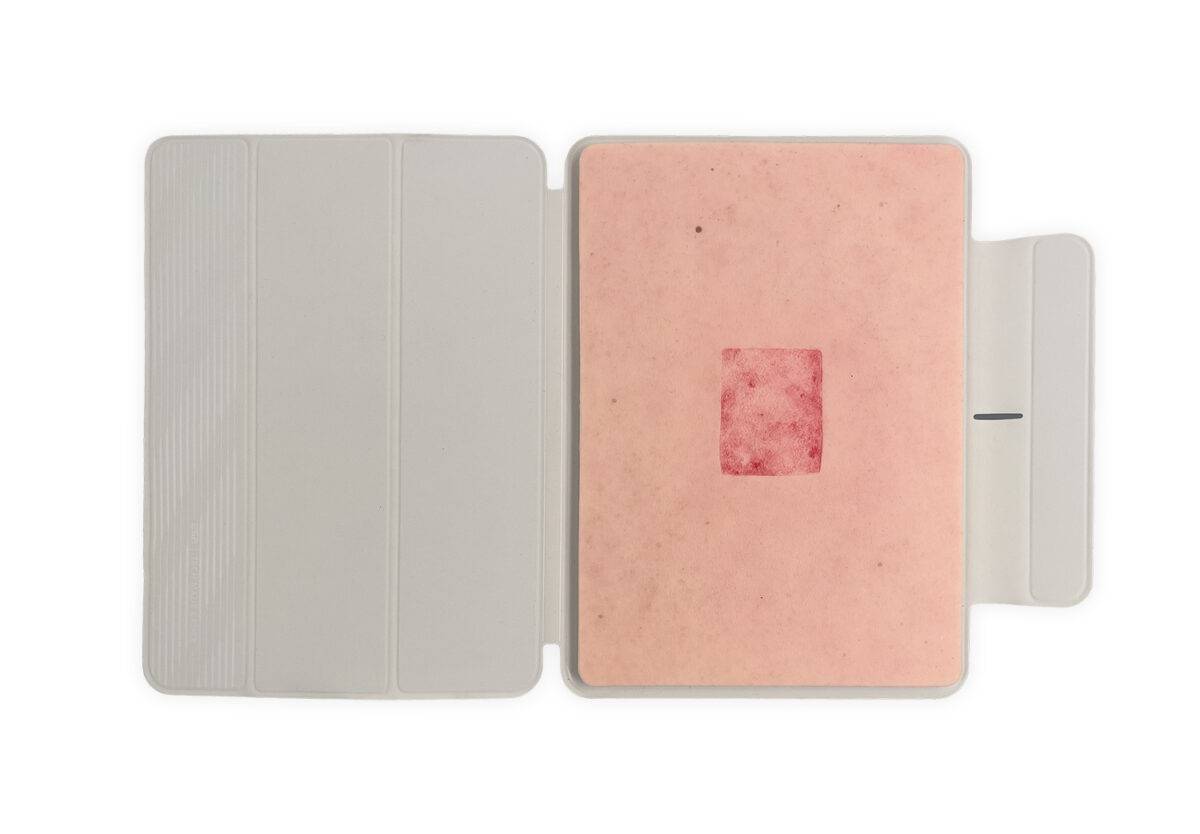 Die „Tabletwunde Hauttransplantation – Donorstelle“ von MEDICAL FX Germany ist ein hochwertiges, handgefertigtes Wundmodell aus Silikon in Tabletgröße. Sie zeigt eine typische Ent…