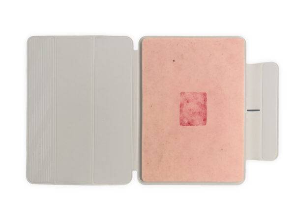 Die „Tabletwunde Hauttransplantation – Donorstelle“ von MEDICAL FX Germany ist ein hochwertiges, handgefertigtes Wundmodell aus Silikon in Tabletgröße. Sie zeigt eine typische Ent…