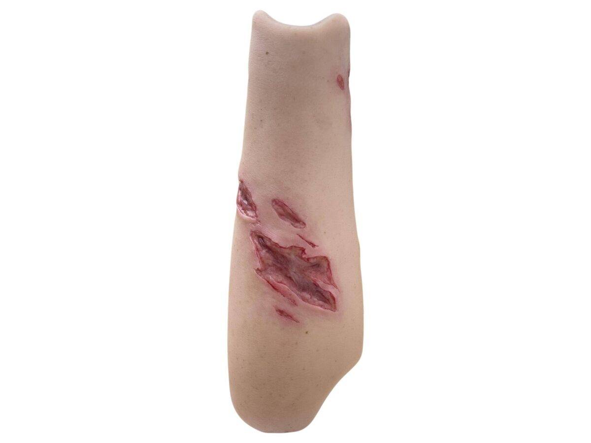 Der „Sleeve Arm mit Risswunde“ von MEDICAL FX Germany ist ein Modell zum Überstülpen, das eine detaillierte Risswunde darstellt und speziell für die Ausbildung in der Wundversorgu…