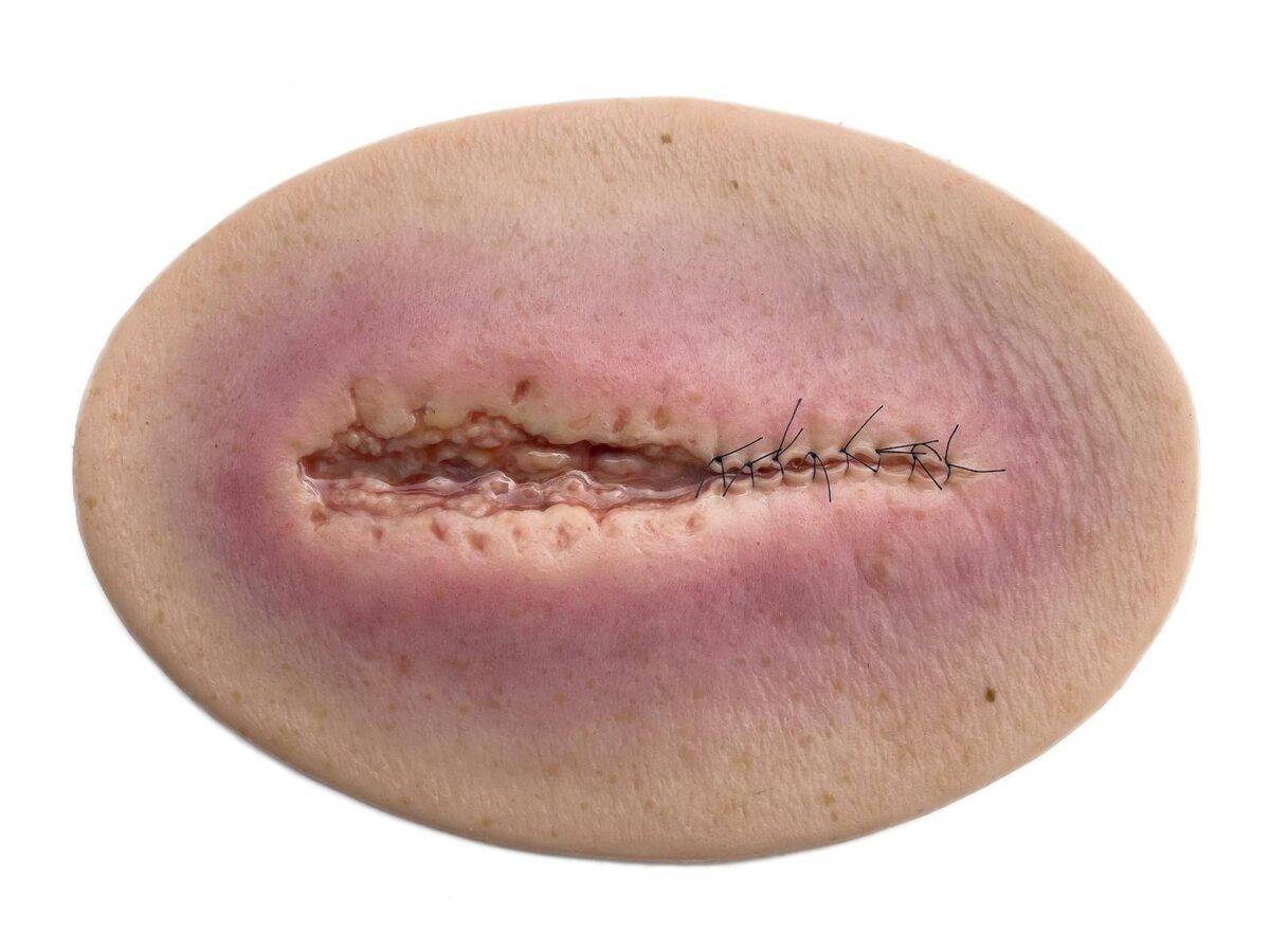 Das „Stick-On Medium OP Wunde, geöffnet"-Modell von MEDICAL FX Germany ist ein hochwertiges, mittelgroßes Silikonmodell zur Darstellung einer offenen Operationswunde. Es zeichnet…