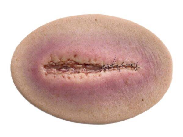 Das „Stick-On Medium OP Wunde, geöffnet"-Modell von MEDICAL FX Germany ist ein hochwertiges, mittelgroßes Silikonmodell zur Darstellung einer offenen Operationswunde. Es zeichnet…