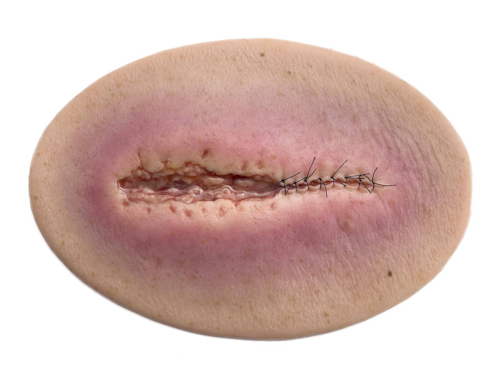 Das „Stick-On Medium OP Wunde, geöffnet"-Modell von MEDICAL FX Germany ist ein hochwertiges, mittelgroßes Silikonmodell zur Darstellung einer offenen Operationswunde. Es zeichnet…