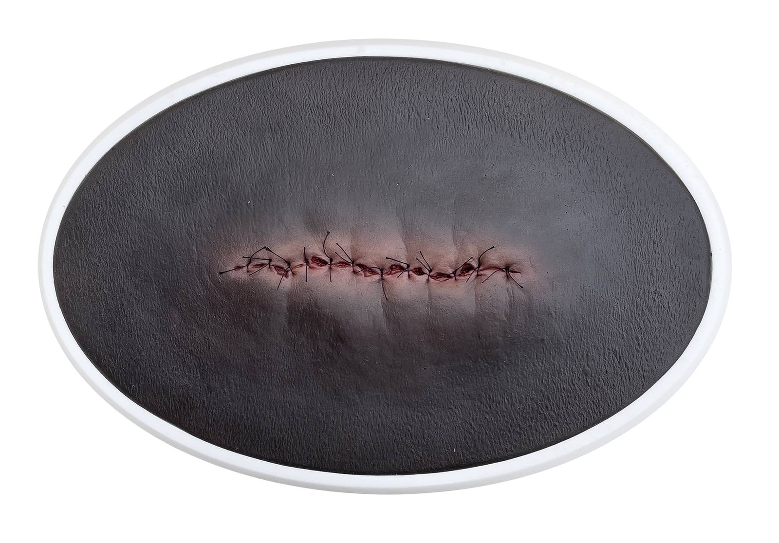 lq op wunde entzuendet geschlossen 4