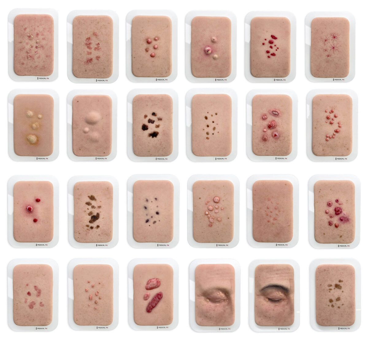 Set aus 23 Pocketwunden - Hautveränderungen