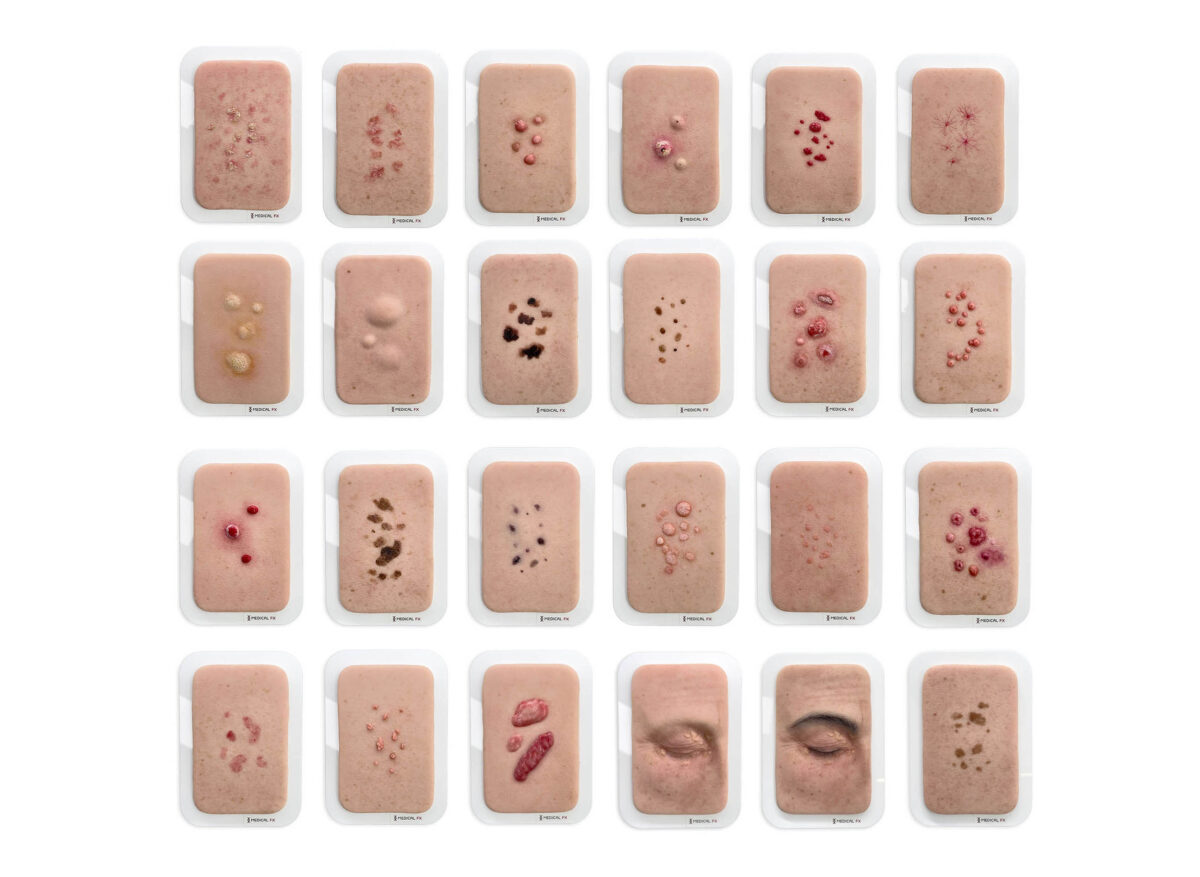 Set aus 23 Pocketwunden - Hautveränderungen