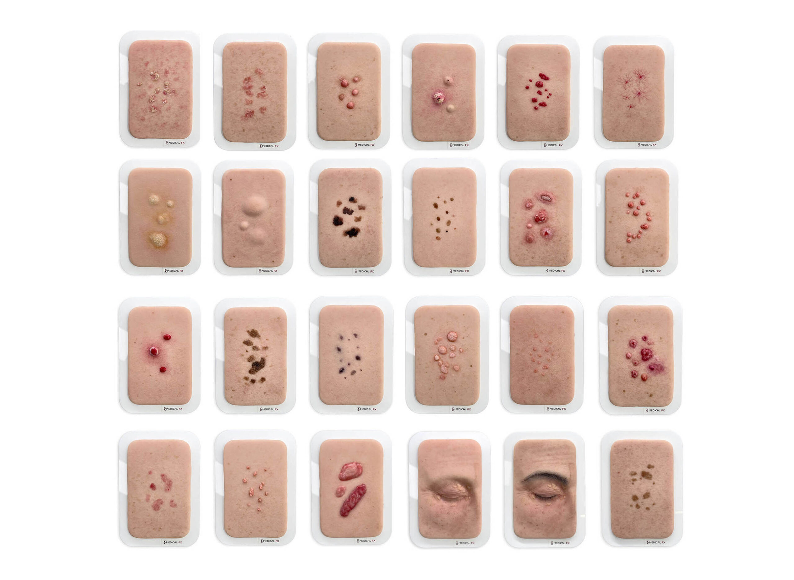 Set aus 23 Pocketwunden - Hautveränderungen – Bild 1